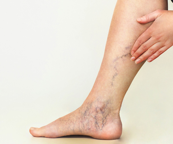 Vascular Surgery Department